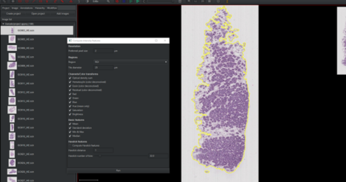 Whole Slide Imaging, Digitalization and Automation of Histopathological ...